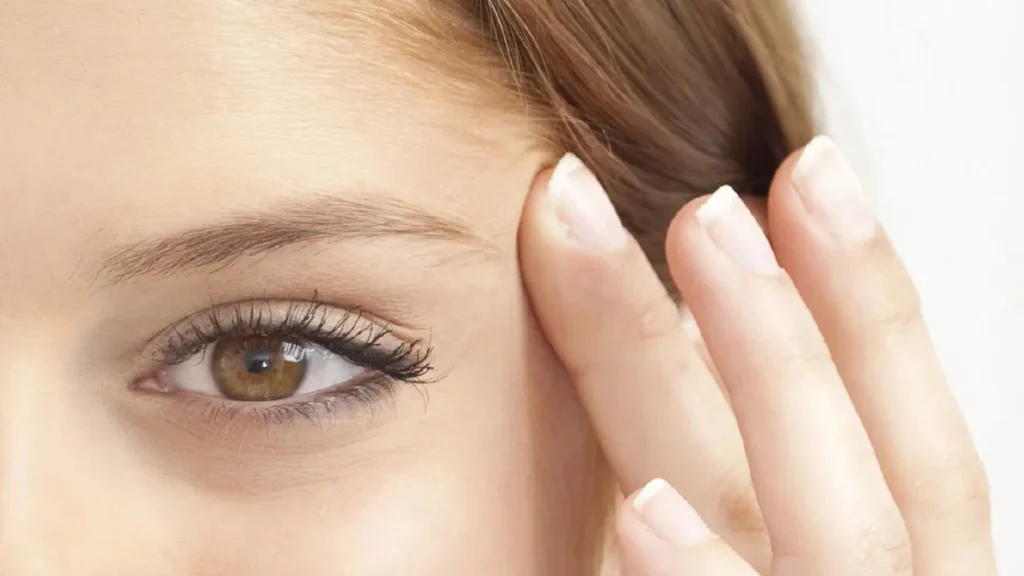 Cat eye botox 1 What is Cat eye botox injection