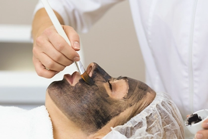 Carbon Peel Laser