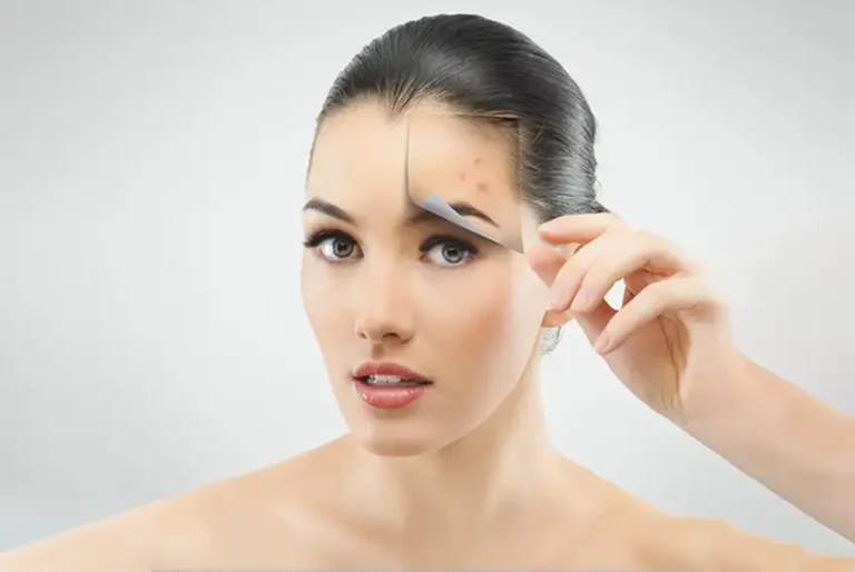 facial spot mesotherapy