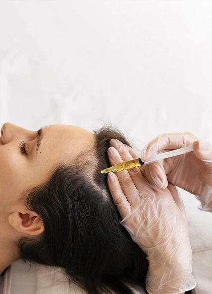 Hair Platelet-rich Plasma