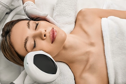 IPL Treatment