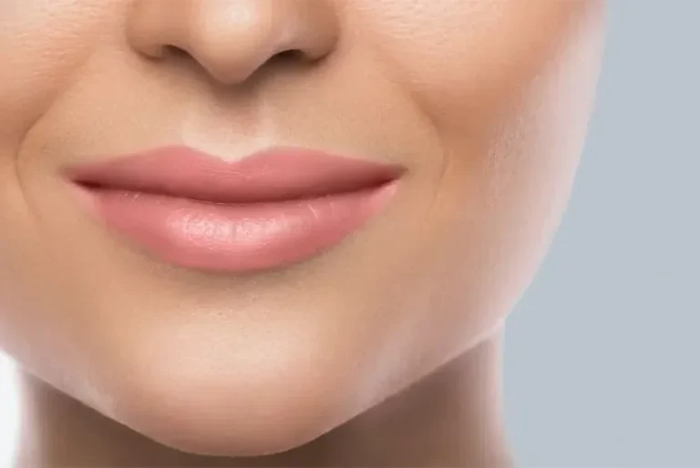 Smile line treatment methods