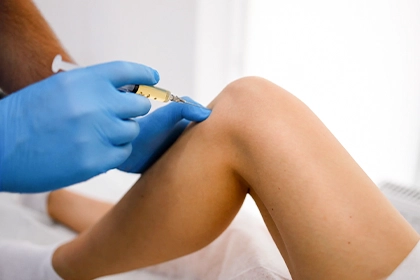 StemCell Therapy