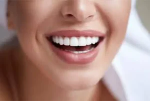 Dental laminate