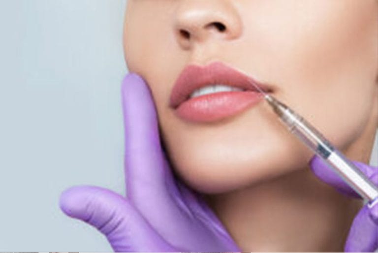 Filler or Botox for upper lip