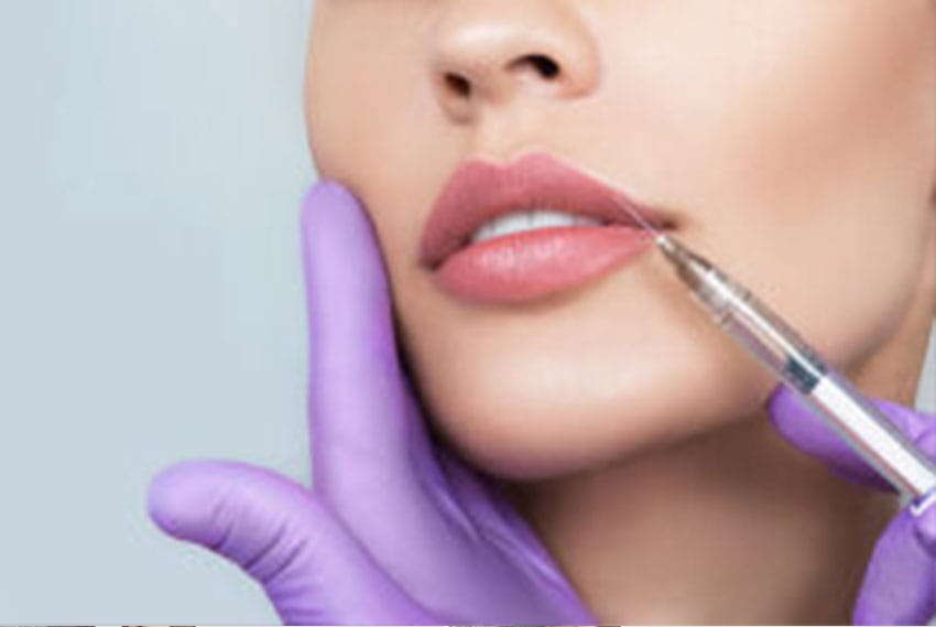 Filler or Botox for upper lip