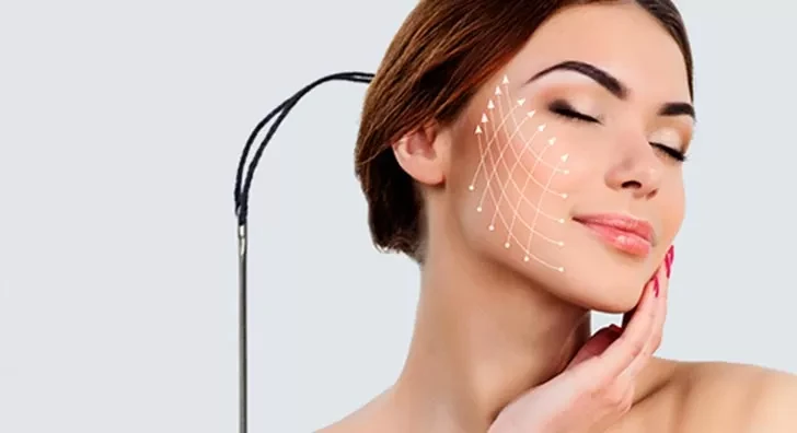 Thread Lift Dubai 4 Thread-lift-by-Serenity-Clinic