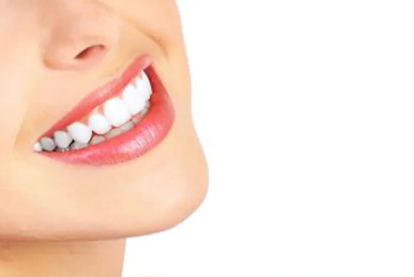 Teeth whitening and bleaching