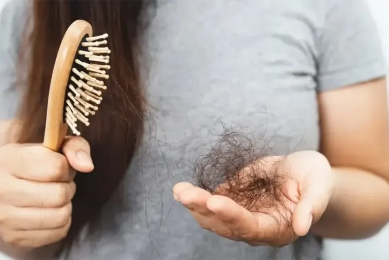 genetic hair loss