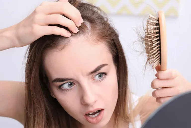hair loss