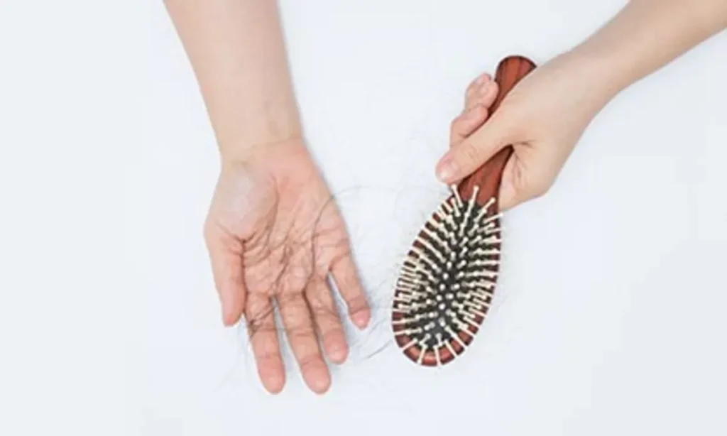 hair loss in men