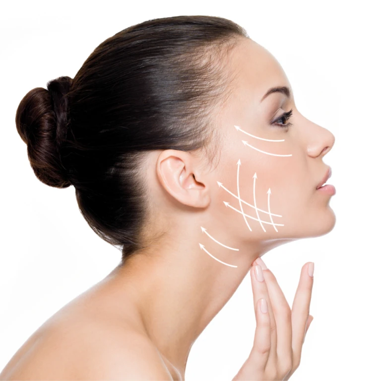 Thread Lift Dubai 6 thread-face