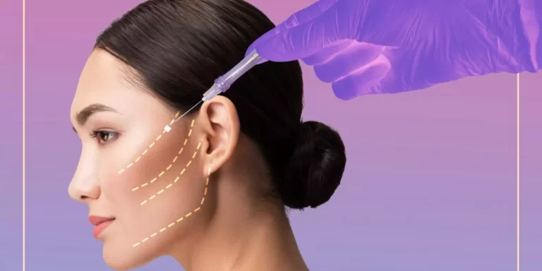 Thread Lift Dubai 5 threads-face-dubai