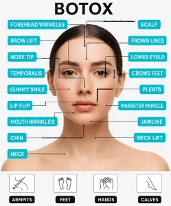 Best Botox in Dubai marina 2 areas you can have botox