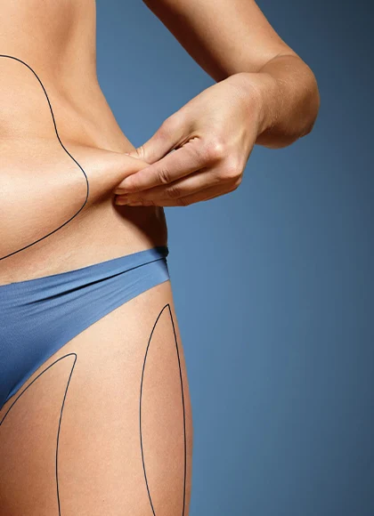 body contouring treatment at serenity