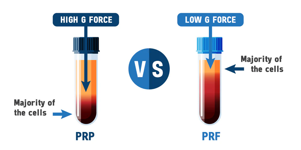 PRF vs PRP Key Differences