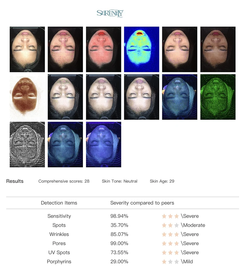 Skin Analysis system 2 Slide 2