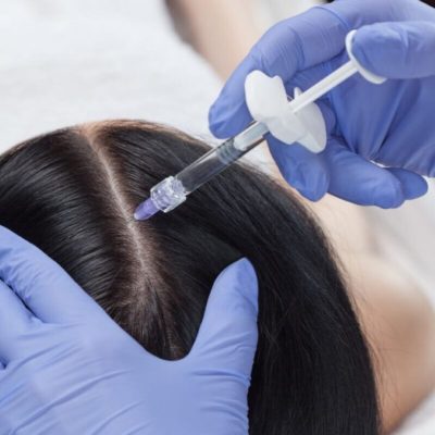 hair filler hair giller serenity clinic hair filler dubai hair filler dubai marina