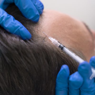 hair mesotherapy hair meso meso therapy dubai mesotherapy dubai marina